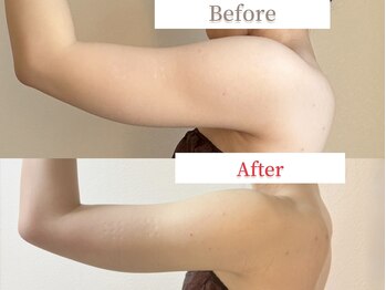 リリーフ(relief)/