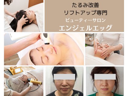 エンジェルエッグの写真