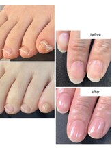 ケアプラス(care plus)/ハンドとフットネイルケア