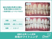 クレア(Crea)/【ホワイトニング症例写真】