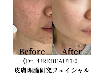 インフィニーズ(INFINEEZ)の写真