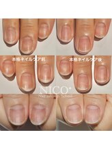 ニコプラス(NICO+)/ジェルネイルができない方向け