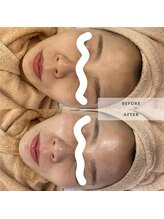 ウルス(ulus)/ビオフィート