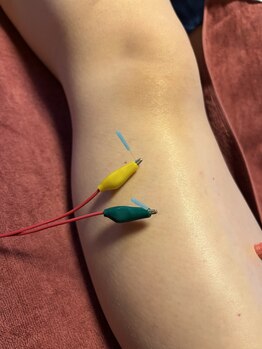 ライズ/Electro Acupuncture