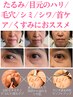 バザルト&EMS【ほうれい線激減!周りから「若見え！」と言われ自信UP!】