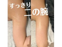 グレアージュ(GLEAGE)/