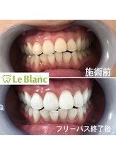 ルブラン 奈良店(Le Blanc)/笑顔に自信が付く一歩！