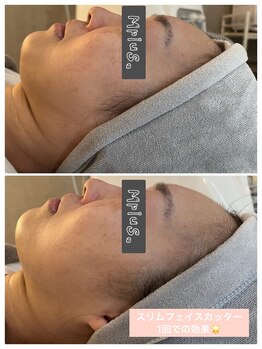 エムプラス(Mplus.)/スリムフェイスカッター♪