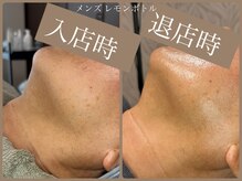 ビーエルティー(blt)/メンズ &nbsp;レモンボトル