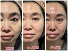 ココロ(Cocoro)/グロッティフェイシャルでの変化