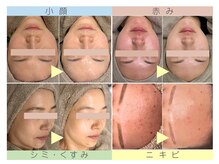 バーガルサロンギンザ(VAGAL SALON GINZA)の雰囲気（結果重視の施術で1回でもしっかりと効果を実感いただけます。）