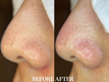 サロン ムスブ(salon MUSUBU)/山梨エステ/甲府エステ