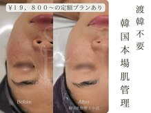 サナビューティーリア(sanaBeauty Lia)の雰囲気（韓国価格でお客様の要望に合わせたメニューで通いやすく♪）