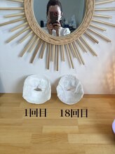 小顔 ツヤ肌/顔は変わります小顔コルギ18回目