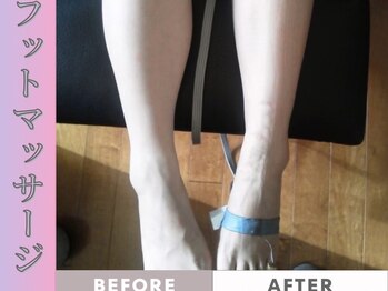 ミモアサロン 岡崎店(mimoaサロン)/【美脚最強】むくみ脚がスッキリ
