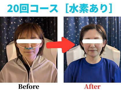 ヨサパーク チュラ カリユシ(YOSA PARK Chura Kariyusea)の写真
