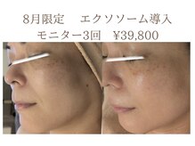 サロン ド エム(salon de m)