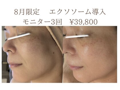 サロン ド エム(salon de m)の写真