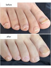 ケアプラス(care plus)/フットネイルケア