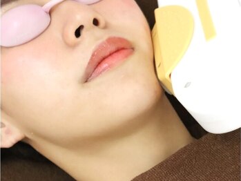 脱毛アンドフェイシャルサロン ルアーナ 心斎橋(LUANA)の写真/【お顔まるごと脱毛+保湿うるつやパック30分¥3000】産毛対応×スピード施術でくすみ・化粧ノリ改善に☆