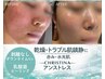 【内側から潤いのある水光肌に特化】小顔コルギ+ CHRISTINA乳酸ピーリング