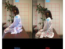 ケアハウス 藤沢(CARE HOUSE)/施術効果写真☆（before after）