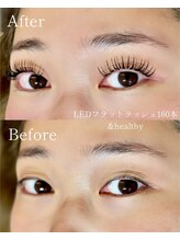 テオ 茂原店(TEO)/LEDフラット＋&healthy