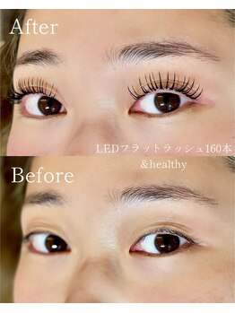 テオ 茂原店(TEO)/LEDフラット＋&healthy