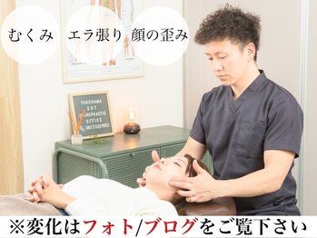 横浜DRT矯正院の写真/【違いのわかる小顔・美顔矯正¥4000】目の周り・頬・エラ等フェイスラインのお悩み根本改善!頭痛や不眠も!