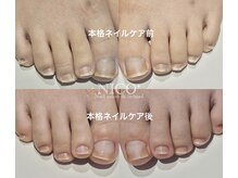 ニコプラス(NICO+)/足のお手入れできていますか？