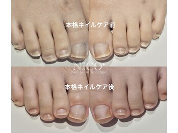 ニコプラス(NICO+)/足のお手入れできていますか?