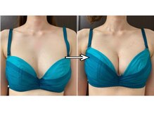 サンボーテ(Sanbeaute)の雰囲気（1度でもふわふわに。サイズアップも可能！驚きの変化を感じて！）