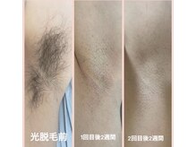 エムグラッティチュード(M gratitude)/