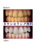 【無料カウンセリング】まずはご相談されたい方はこちら