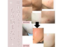 リノ(LINO)の雰囲気（お肌で悩んでる方！！ぜひLINOへ♪）