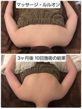 ヨサパーク ライズ 大日(YOSA PARK RISE)/BeforeAfter