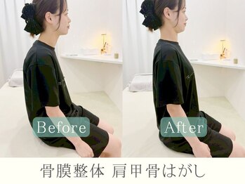ヒラメント 浜松町(Hilament)/肩甲骨はがしで肩こりの改善