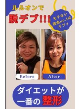 ヨサパーク ミミン(YOSA PARK mimin)/ダイエットしたら垢抜けた