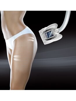 シェリール(Cherir)の写真/何をしても変わらなかった下半身に本気のアプローチ！後ろ姿に自信が持てるスッキリ整うボディーラインへ♪