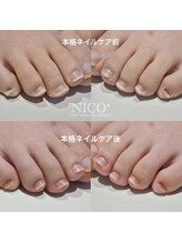 ニコプラス(NICO+)/足のお手入れできていますか？