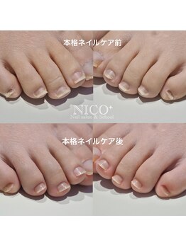 ニコプラス(NICO+)/足のお手入れできていますか?