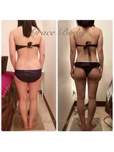 グレイスボディ BiViつくば店(Grace Body)/◆痩身　症例写真