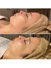 レアリゼ(Realiser)/全メニューたっぷりマッサージ！