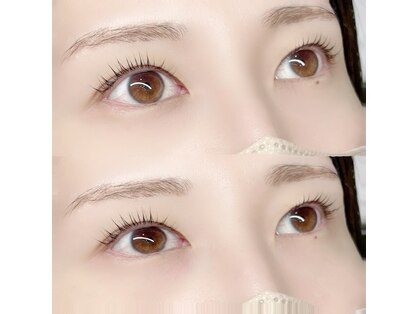 プラチナム(Platinum)の写真