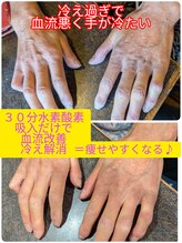 ヨサパーク アエル(YOSA PARK AELL)/高濃度水素・酸素吸入60分だけ！