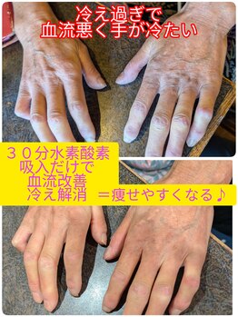 ヨサパーク アエル(YOSA PARK AELL)/高濃度水素・酸素吸入60分だけ！