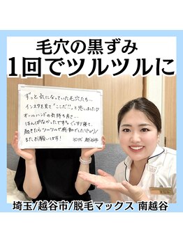 脱毛マックス 南越谷店(MAX)/気になる毛穴の黒ずみザラつきに