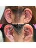 大人気☆耳つぼジュエリー♪【肩こり＆腰痛コース両耳10粒】￥２，５００♪
