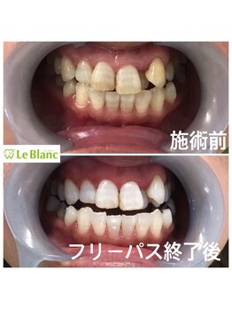 ルブラン 奈良店(Le Blanc)/朝9時からお仕事前に