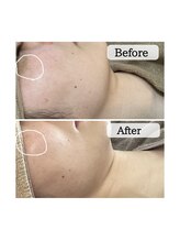 ル ボヌール 伊那店(le bonheur)/3ヶ月　月に2回のご来店